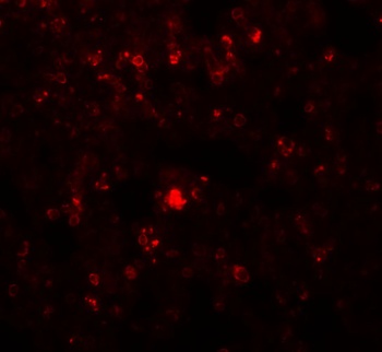 RHBDD2 Antibody