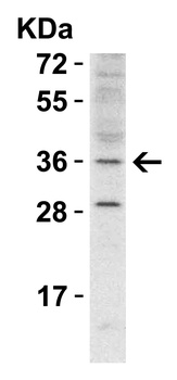 RHBDD1 Antibody