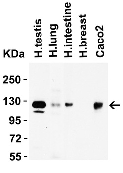 ACE2 Antibody