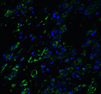 ACE2 Antibody