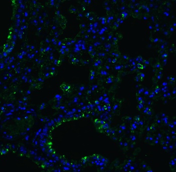 ACE2 Antibody