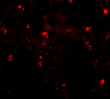 RGPD5 Antibody