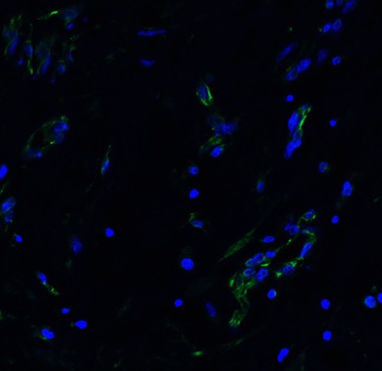 ACE2 Antibody