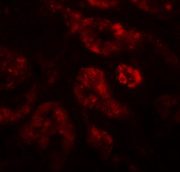 REQUIEM Antibody