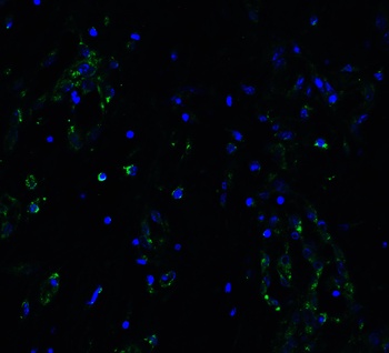 ACE2 Antibody