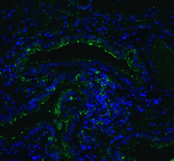 ACE2 Antibody