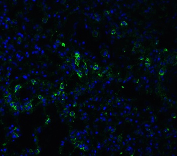 ACE2 Antibody