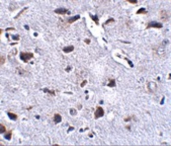 Rcan2 Antibody