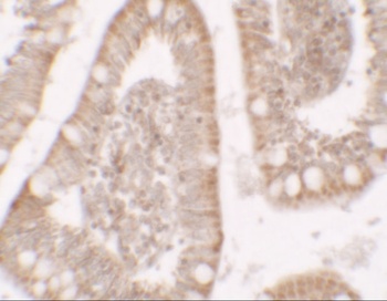 RC3H1 Antibody