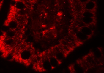 RC3H1 Antibody