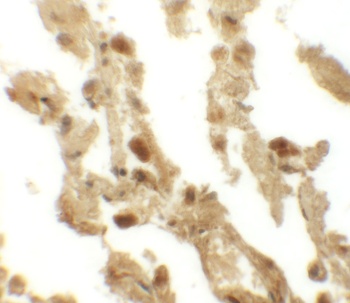 RBM35B Antibody