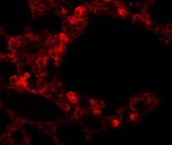 RBM35B Antibody