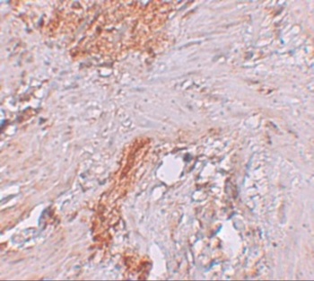 ESRP1 Antibody