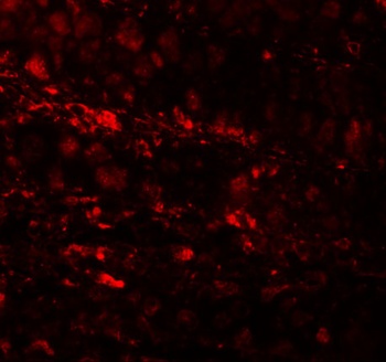 ESRP1 Antibody