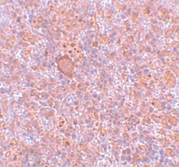 RBBP8 Antibody