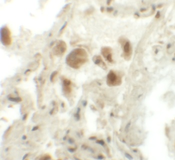 RASSF10 Antibody