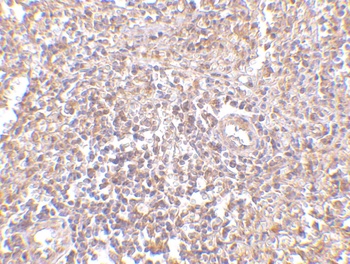 UIMC1 Antibody