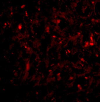 UIMC1 Antibody