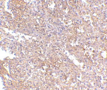 RAP80 Antibody