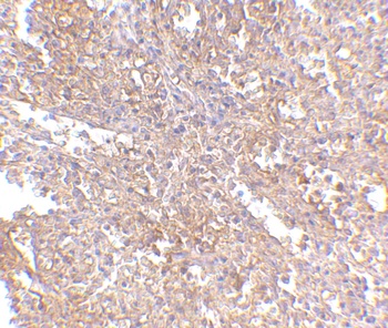 UIMC1 Antibody