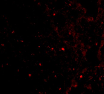 RAP80 Antibody