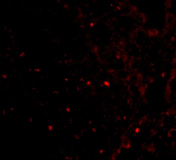 UIMC1 Antibody