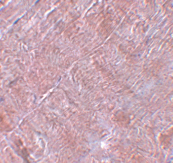 RANBP10 Antibody