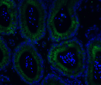 ADAM10 Antibody