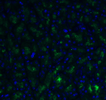 ADAM10 Antibody