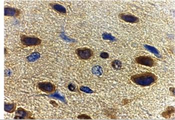 Adiponectin Antibody