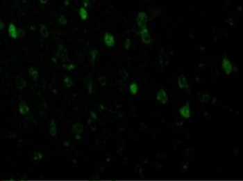 Adiponectin Antibody