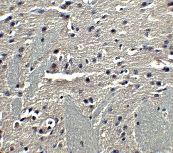 Adiponectin Antibody
