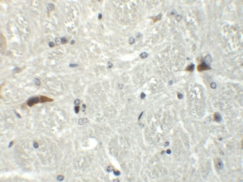 RABEX5 Antibody