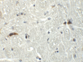 RABGEF1 Antibody