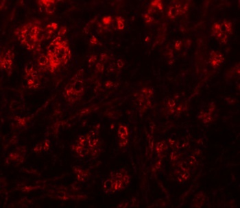 RABEX5 Antibody