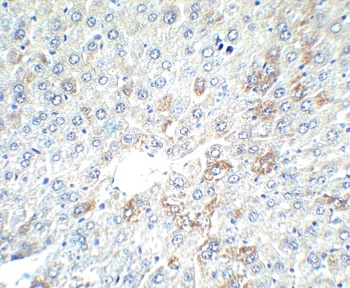 AFP Antibody