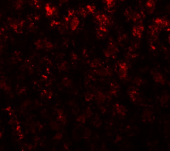 AFP Antibody