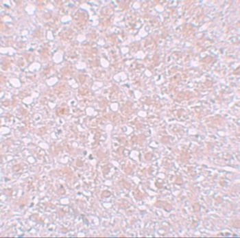 AFP Antibody