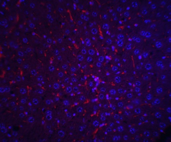 AFP Antibody