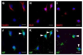 AIFM1 Antibody