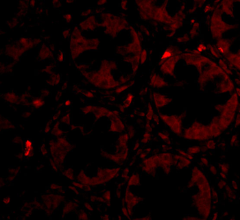 PTK7 Antibody