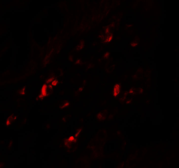 PTGDR2 Antibody