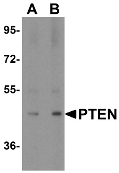 PTEN Antibody
