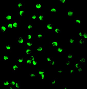 PTEN Antibody
