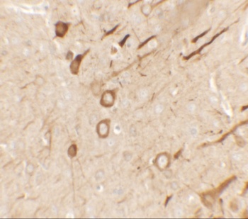 PRRT2 Antibody