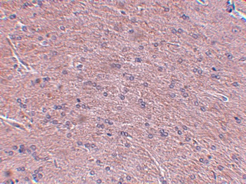 ProSAPiP1 Antibody