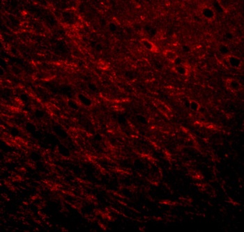 Prosapip1 Antibody