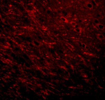 ProSAPiP1 Antibody