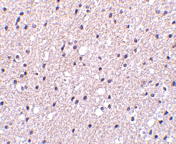 PSEN1 Antibody