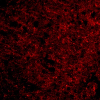 Presenilin1 Antibody